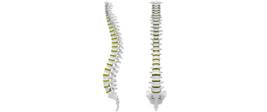 脊髄脊椎疾患の診断・治療